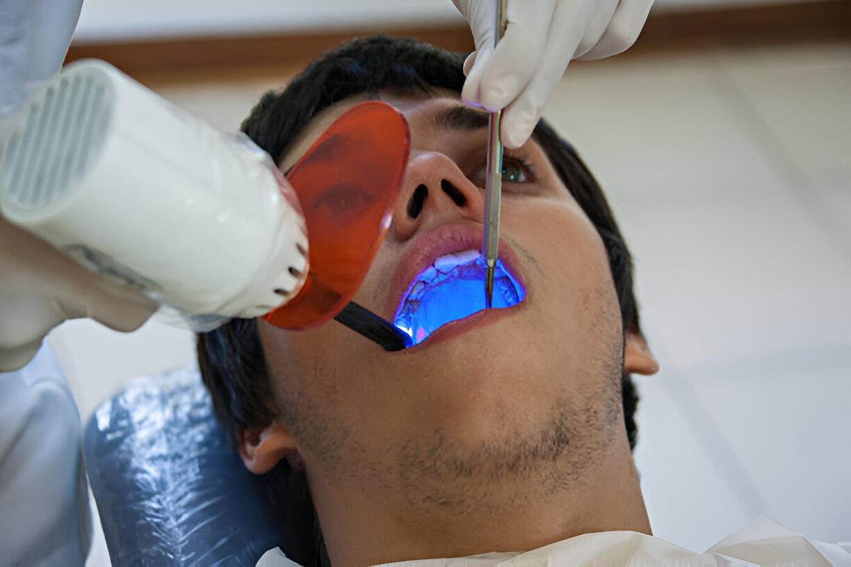 How Root Canal Therapy Can Save Your Tooth and Improve Oral Health_2