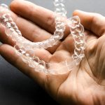 The Ultimate Guide to Invisalign for Teens and Adults_FI