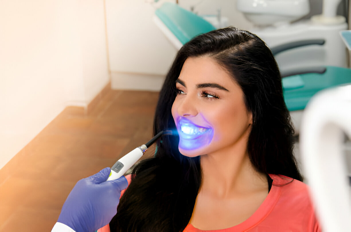 Your Guide to Teeth Whitening: What to Expect at Cane Bay Family Dentistry in Summerville, SC_1